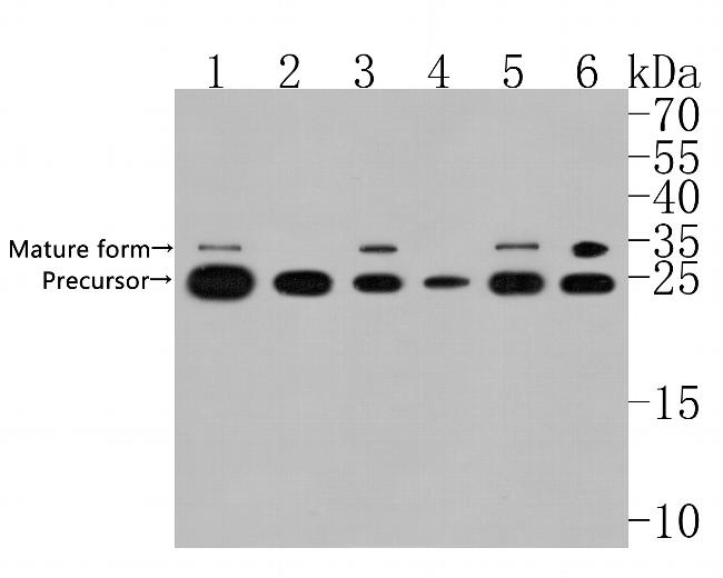 CTR1 Antibody in Western Blot (WB)