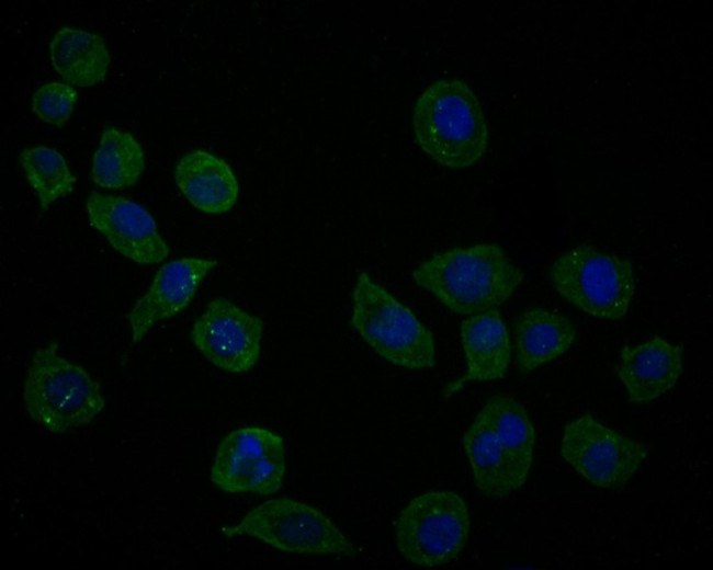 UBE4A Antibody in Immunocytochemistry (ICC/IF)