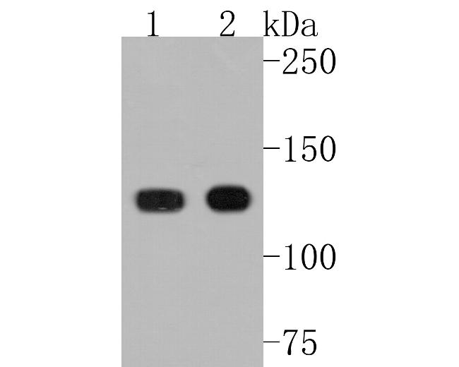 UBE4A Antibody in Western Blot (WB)