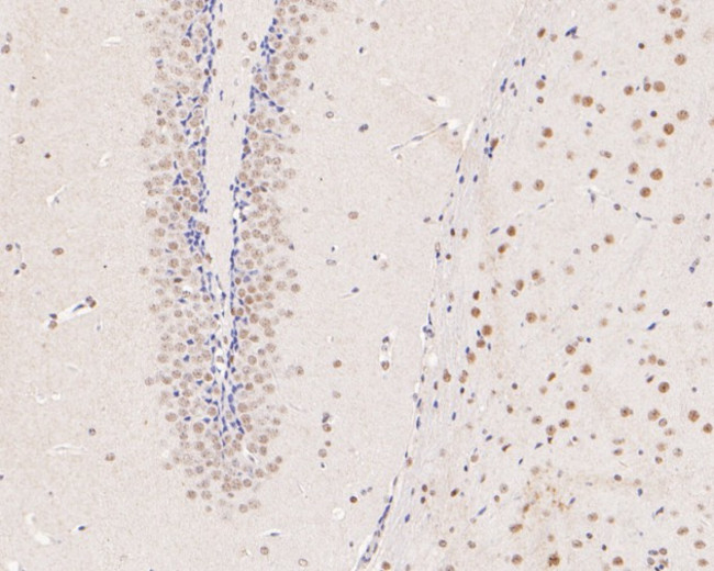 METTL3 Antibody in Immunohistochemistry (Paraffin) (IHC (P))