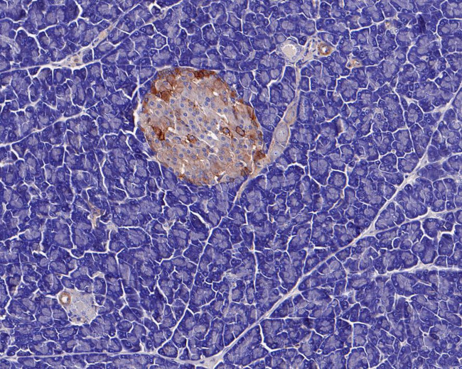 GNAS Antibody in Immunohistochemistry (Paraffin) (IHC (P))