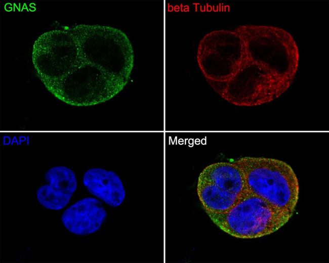 GNAS Antibody in Immunocytochemistry (ICC/IF)