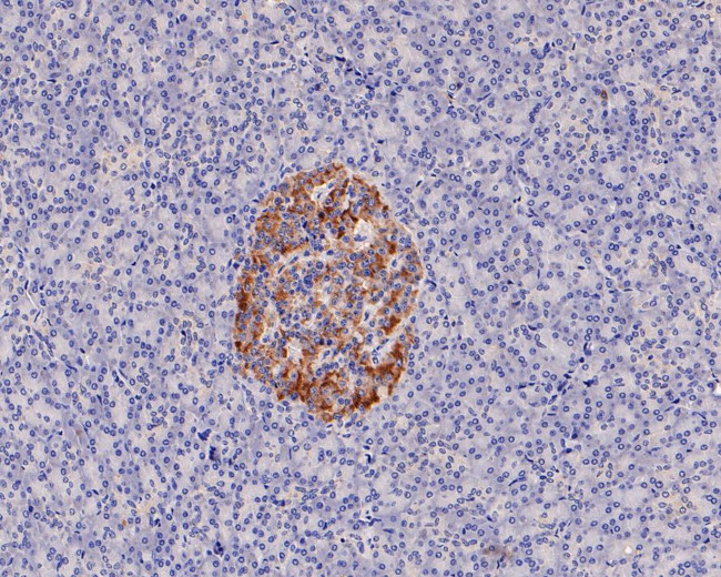 GNAS Antibody in Immunohistochemistry (Paraffin) (IHC (P))