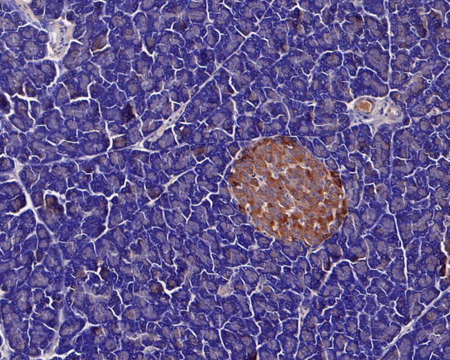 GNAS Antibody in Immunohistochemistry (Paraffin) (IHC (P))