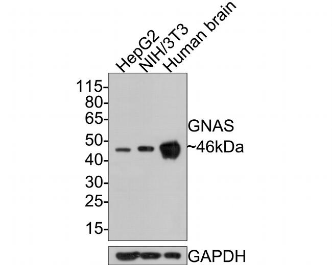 GNAS Antibody in Western Blot (WB)