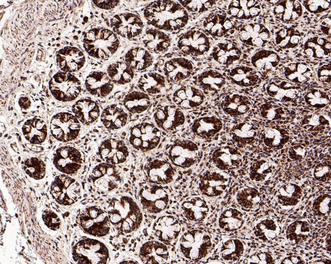 C1QBP Antibody in Immunohistochemistry (Paraffin) (IHC (P))