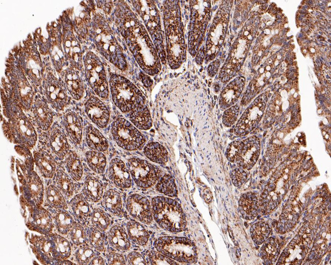 C1QBP Antibody in Immunohistochemistry (Paraffin) (IHC (P))