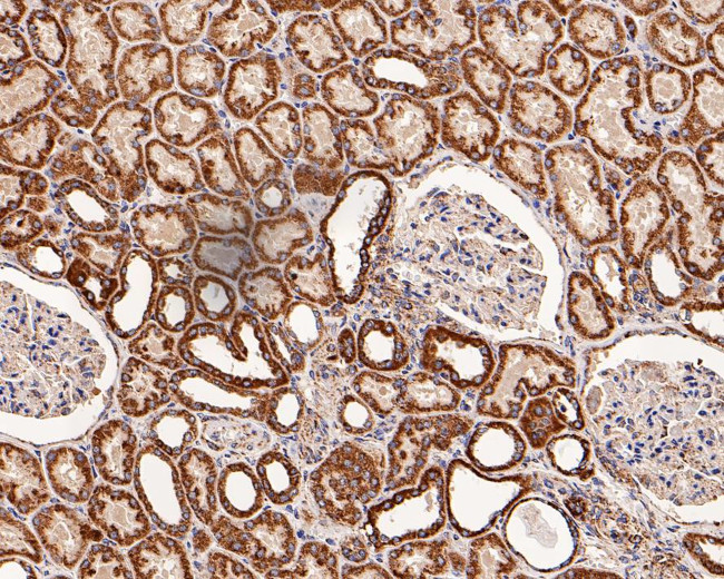 C1QBP Antibody in Immunohistochemistry (Paraffin) (IHC (P))