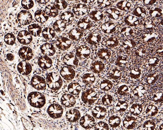 C1QBP Antibody in Immunohistochemistry (Paraffin) (IHC (P))