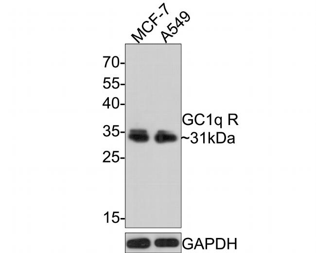 C1QBP Antibody in Western Blot (WB)