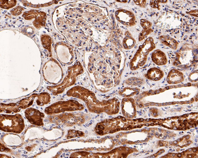 CD161 Antibody in Immunohistochemistry (Paraffin) (IHC (P))