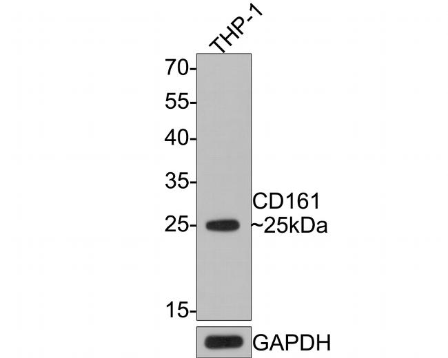 CD161 Antibody in Western Blot (WB)