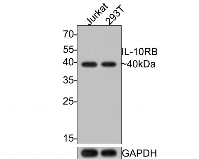 IL10RB Antibody in Western Blot (WB)