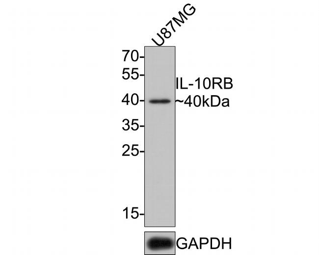 IL10RB Antibody in Western Blot (WB)