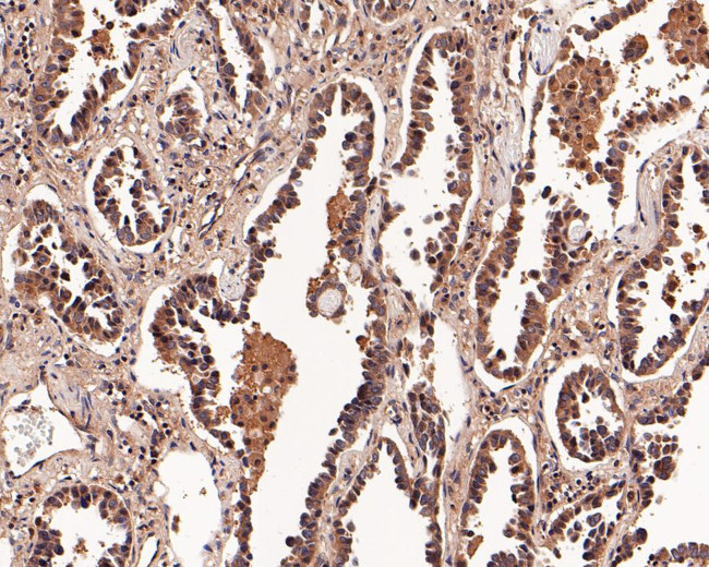 K-Ras Antibody in Immunohistochemistry (Paraffin) (IHC (P))