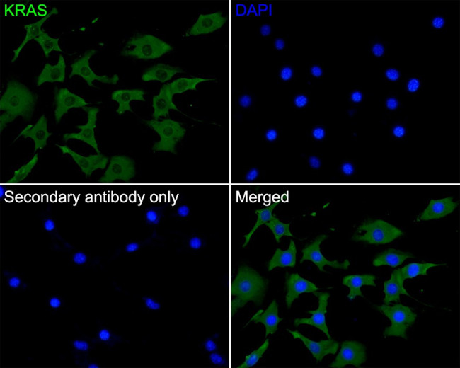 K-Ras Antibody in Immunocytochemistry (ICC/IF)