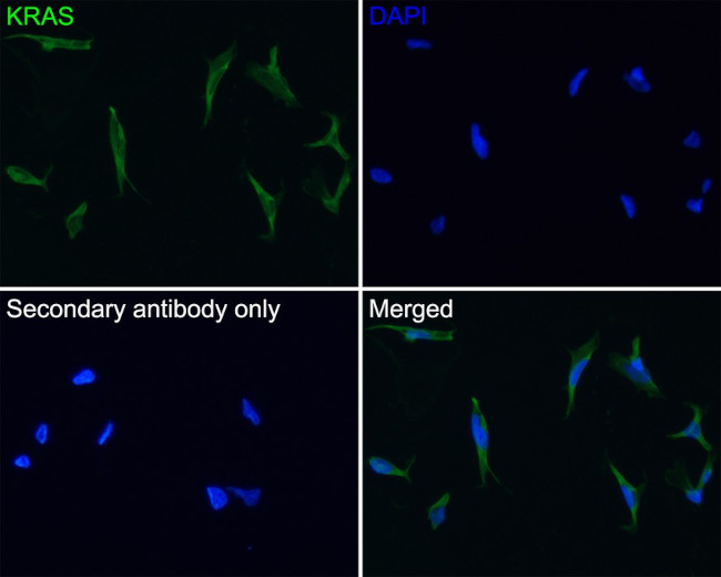 K-Ras Antibody in Immunocytochemistry (ICC/IF)