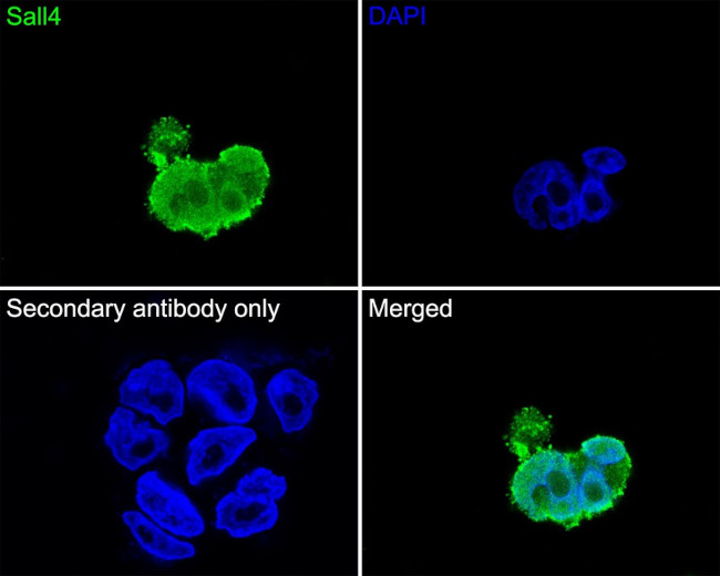 SALL4 Antibody in Immunocytochemistry (ICC/IF)