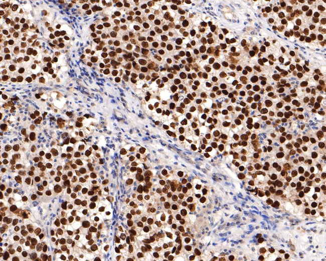 SALL4 Antibody in Immunohistochemistry (Paraffin) (IHC (P))