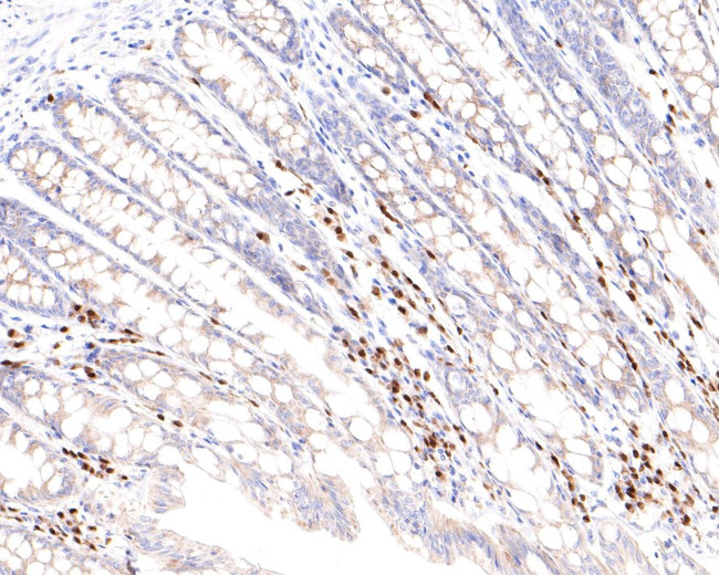 IRF4 Antibody in Immunohistochemistry (Paraffin) (IHC (P))