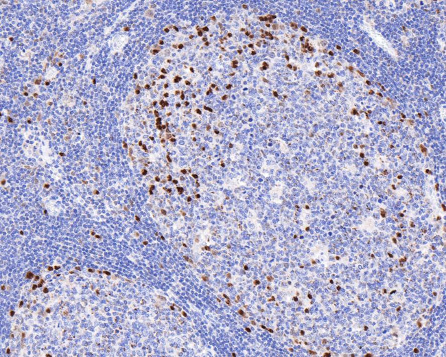 IRF4 Antibody in Immunohistochemistry (Paraffin) (IHC (P))