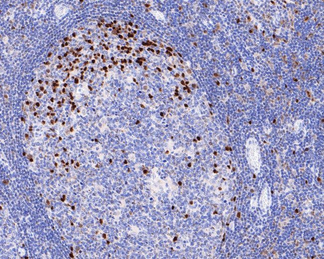 IRF4 Antibody in Immunohistochemistry (Paraffin) (IHC (P))