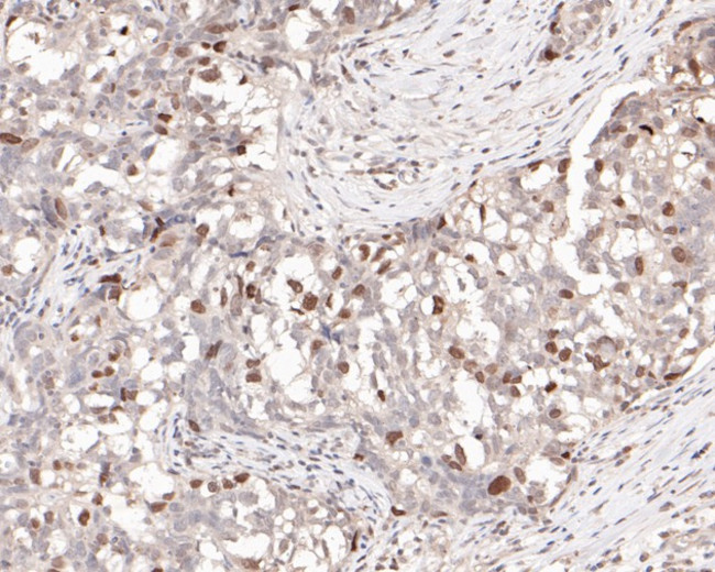 TOP2A Antibody in Immunohistochemistry (Paraffin) (IHC (P))