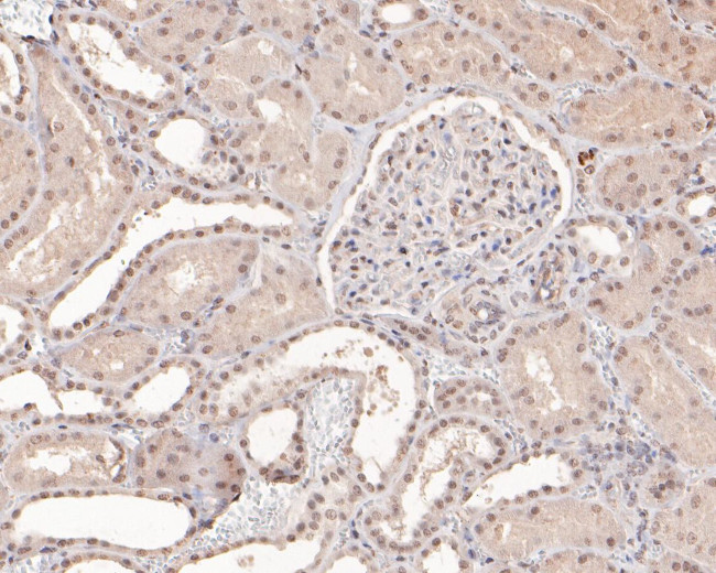 BRG1 Antibody in Immunohistochemistry (Paraffin) (IHC (P))