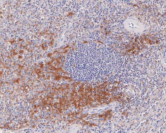 CD42a Antibody in Immunohistochemistry (Paraffin) (IHC (P))