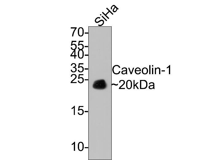 Caveolin 1 Antibody in Western Blot (WB)