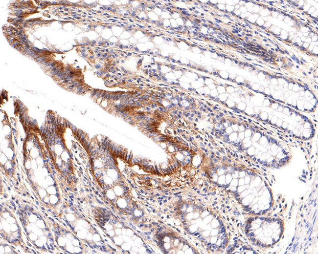 SLC7A11 Antibody in Immunohistochemistry (Paraffin) (IHC (P))