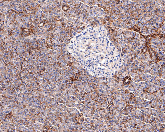 SLC7A11 Antibody in Immunohistochemistry (Paraffin) (IHC (P))