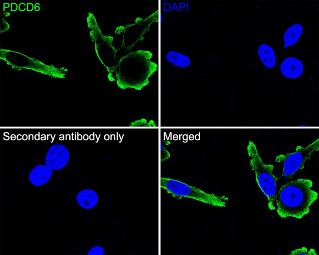 PDCD6 Antibody in Immunocytochemistry (ICC/IF)