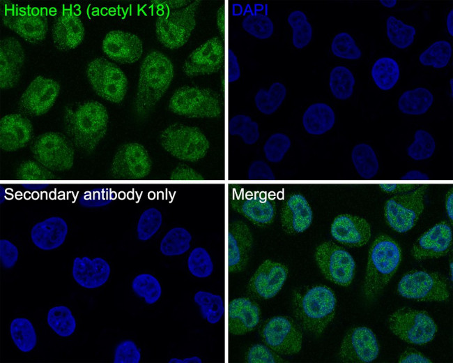 H3K18ac Antibody in Immunocytochemistry (ICC/IF)