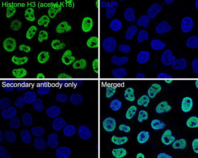 H3K18ac Antibody in Immunocytochemistry (ICC/IF)