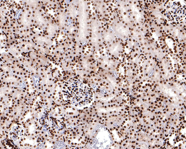 H3K18ac Antibody in Immunohistochemistry (Paraffin) (IHC (P))