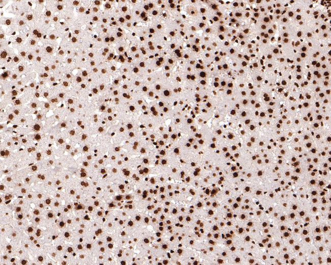 H3K18ac Antibody in Immunohistochemistry (Paraffin) (IHC (P))