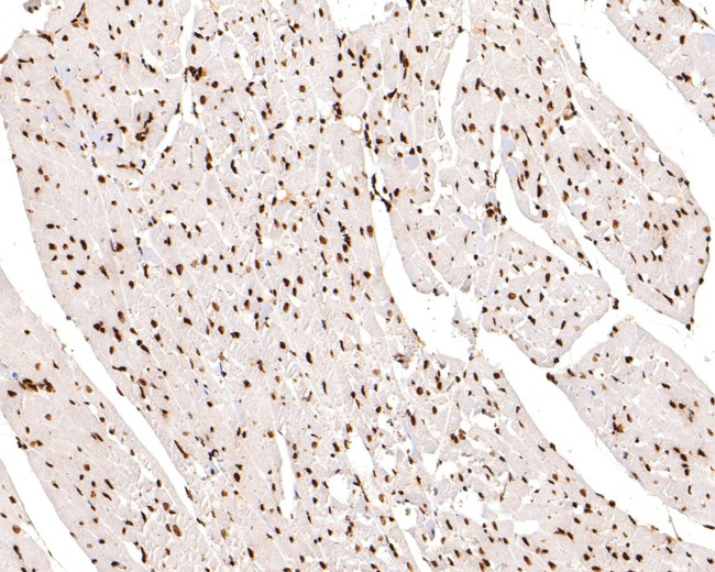 H3K18ac Antibody in Immunohistochemistry (Paraffin) (IHC (P))