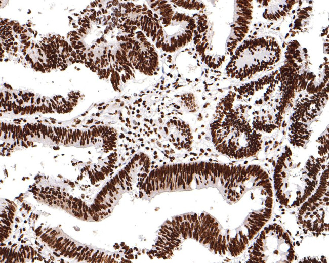 H3K18ac Antibody in Immunohistochemistry (Paraffin) (IHC (P))