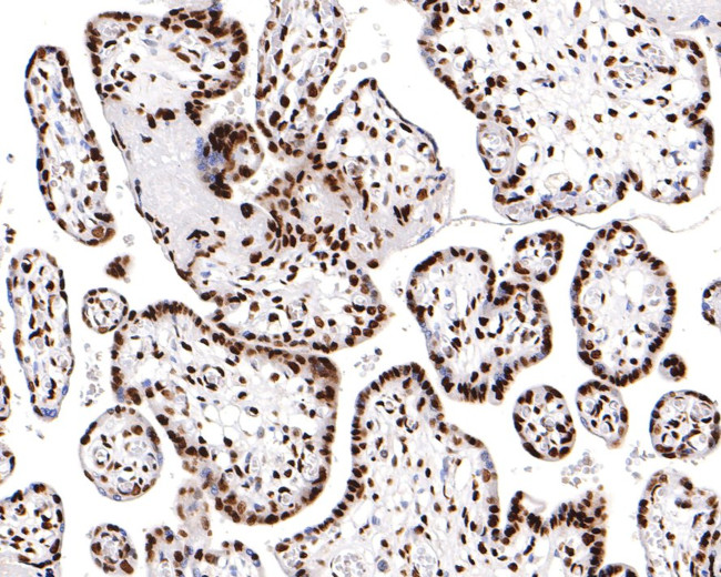 H3K18ac Antibody in Immunohistochemistry (Paraffin) (IHC (P))