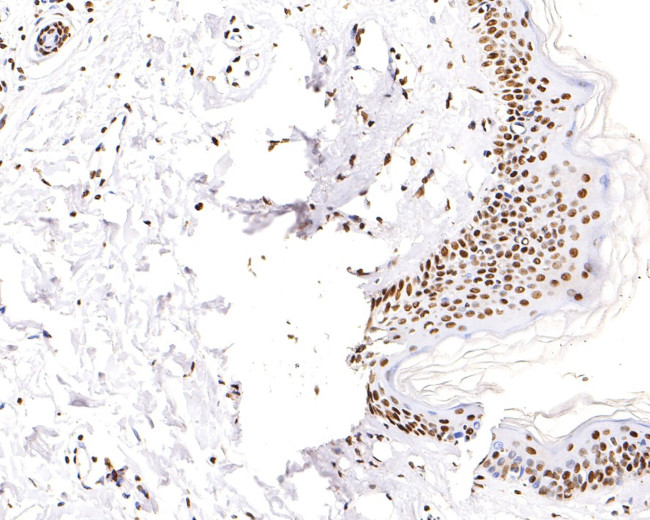 H3K18ac Antibody in Immunohistochemistry (Paraffin) (IHC (P))