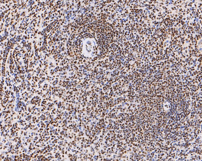 H3K18ac Antibody in Immunohistochemistry (Paraffin) (IHC (P))