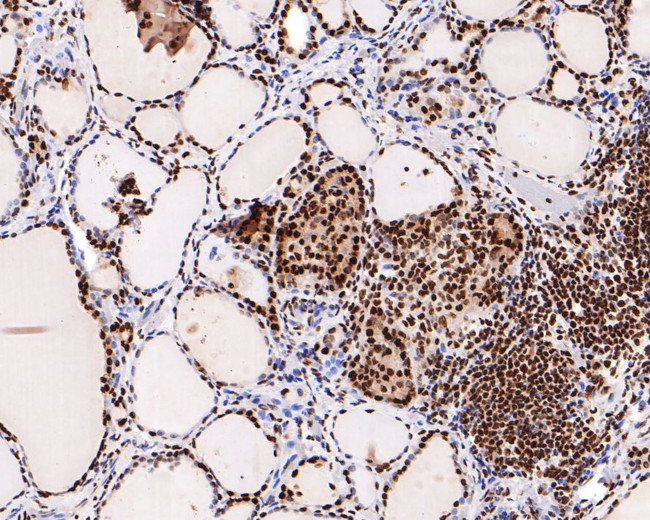 H3K18ac Antibody in Immunohistochemistry (Paraffin) (IHC (P))