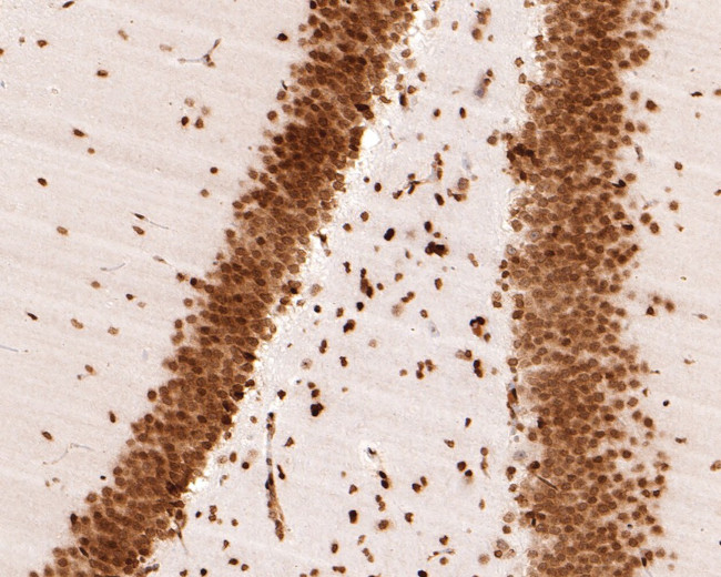 H3K18ac Antibody in Immunohistochemistry (Paraffin) (IHC (P))