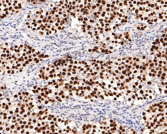 SALL4 Antibody in Immunohistochemistry (Paraffin) (IHC (P))