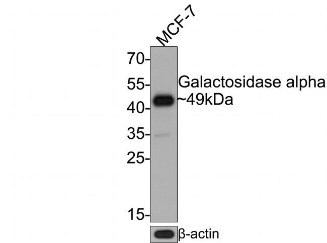 alpha Galactosidase Antibody in Western Blot (WB)