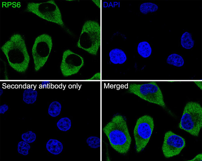 S6 Antibody in Immunocytochemistry (ICC/IF)