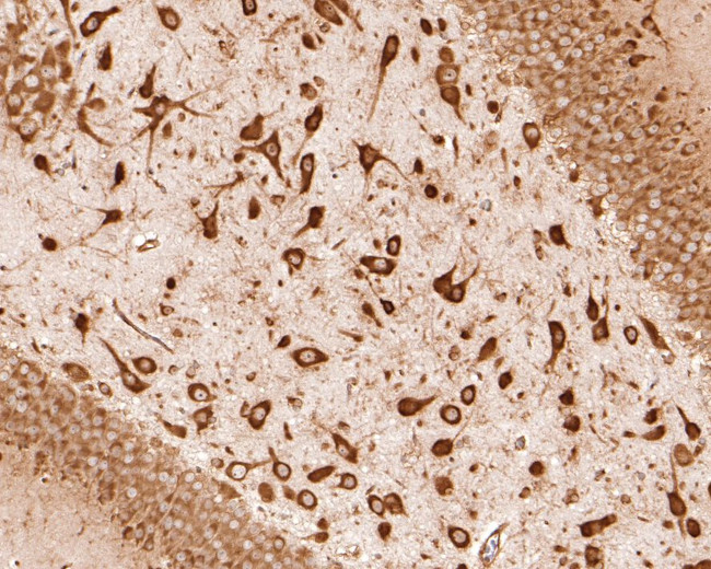 S6 Antibody in Immunohistochemistry (Paraffin) (IHC (P))