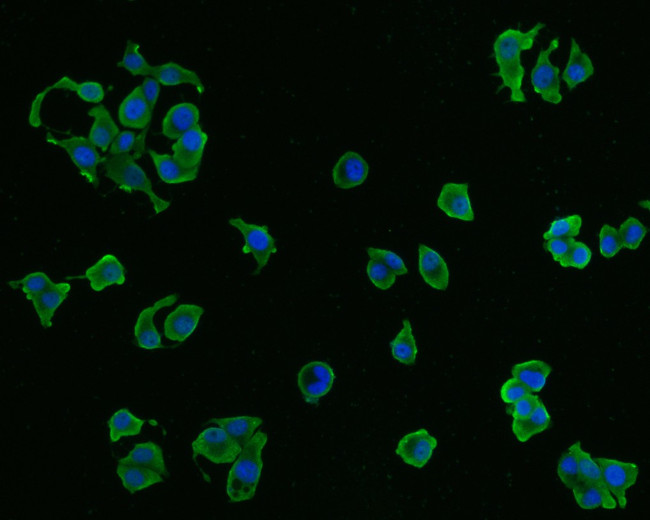 CX3CR1 Antibody in Immunocytochemistry (ICC/IF)