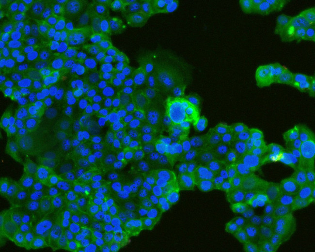 TROP2 Antibody in Immunocytochemistry (ICC/IF)